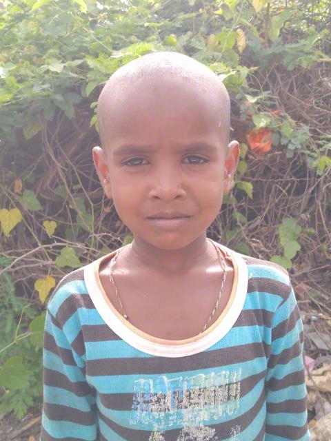 World Vision India